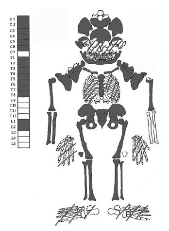 Figura 6. Individuo N° 1