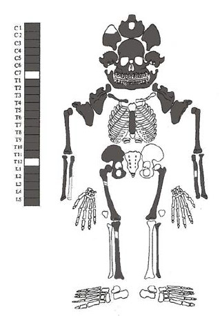 Figura 7. Individuo N° 2.