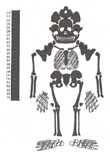 Figura 8. Individuo N° 3