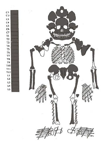 Figura 9. Individuo N° 4