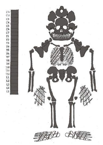 Figura 10. Individuo N° 5